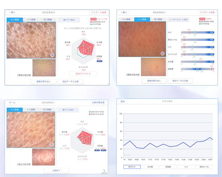 スマートスキンケア-Smart Skin Careのマイクロスコープで撮影したデータはキメ・毛穴・シミ・水分量・美白値・皮脂量などのグラフでご覧になれます。
